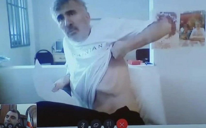 Saakaşvilidən şok: “Məni Rusiya agentləri zəhərləyib”