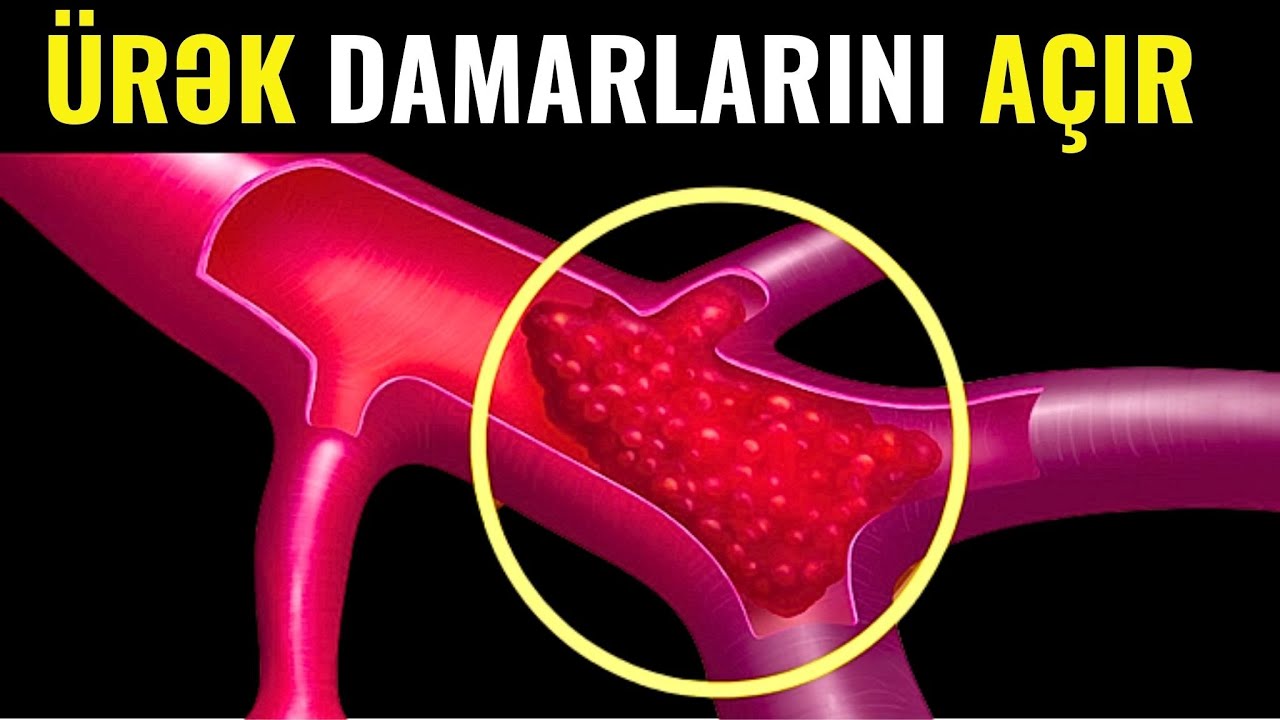Bu qida ürəyə gedən damarları 5 qəqiqəyə təmizləyir (VİDEO)