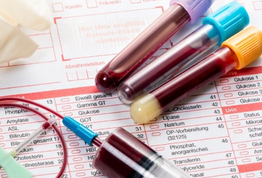 QANIN ÜMUMİ ANALİZİ NƏDİR? - Bu problemləri öyrənmək olar