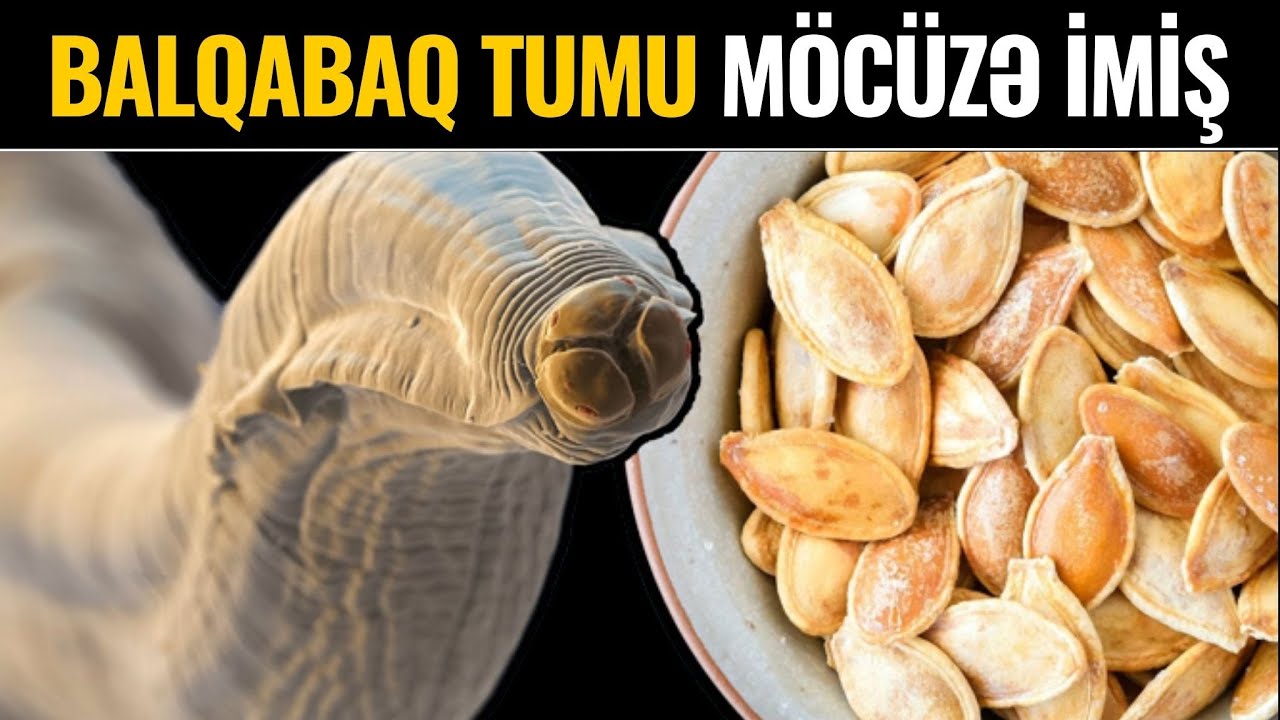 Qətiyyən Zibilə Atmayın! - Görün İnsana Nələr Edir...