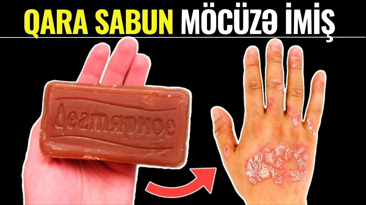 QARA SABUN Görün Nələrə Çarəymiş! - 90% İnsan BUNU BİLMİR