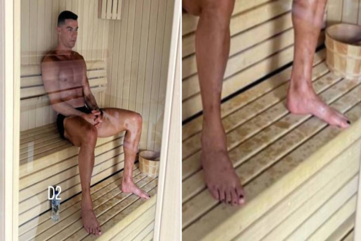Ronaldo dırnağına niyə lak çəkir? - ŞOK SƏBƏB