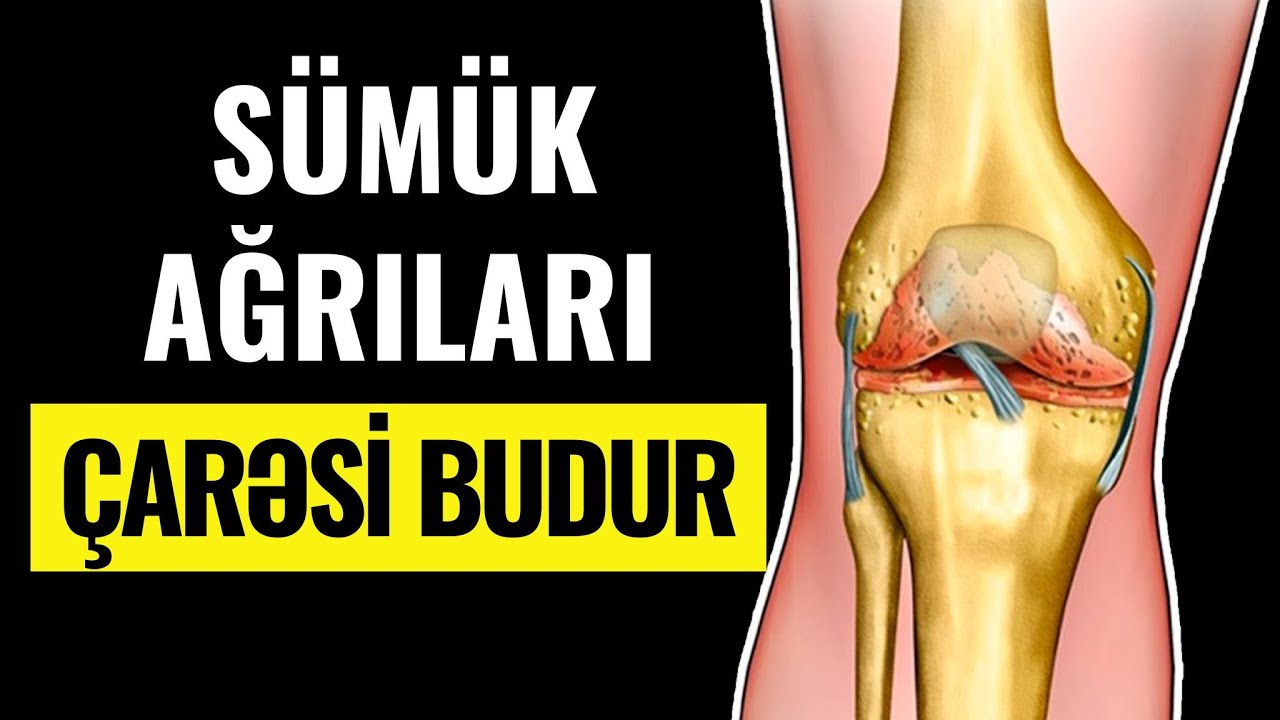Oynaqlarınız ağrıyırsa baxın! - Sümüklərin bərpası  belə mümkündür