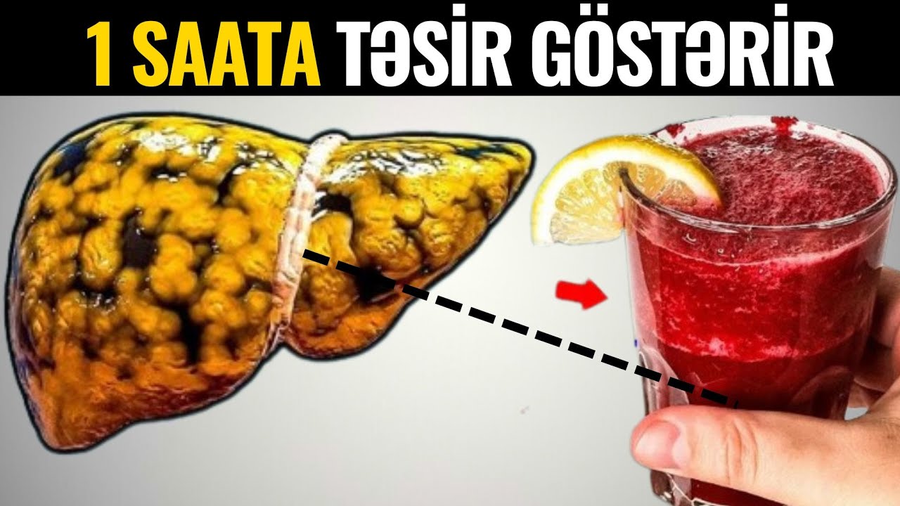 Bunu İçən kimi Qaraciyər, Təzyiq və Qəbizlik problemi YOXA ÇIXIR
