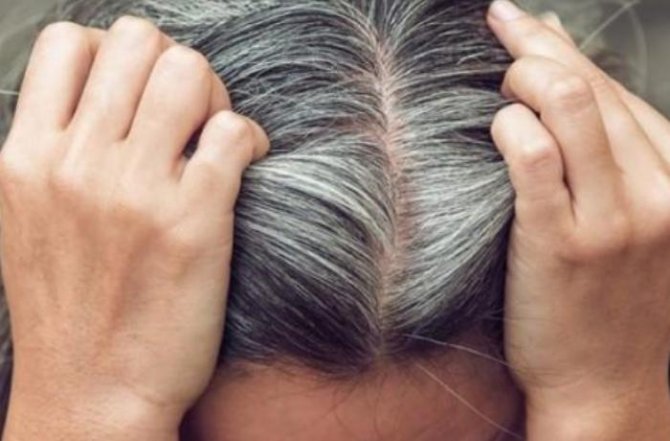 Saçlarımız niyə vaxtından tez ağarır? - Xəstəlik ola bilər…