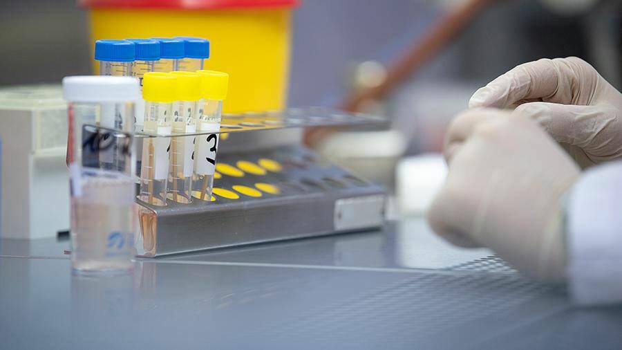 İranda bu virus yayılır - Artıq 3 nəfər ölüb