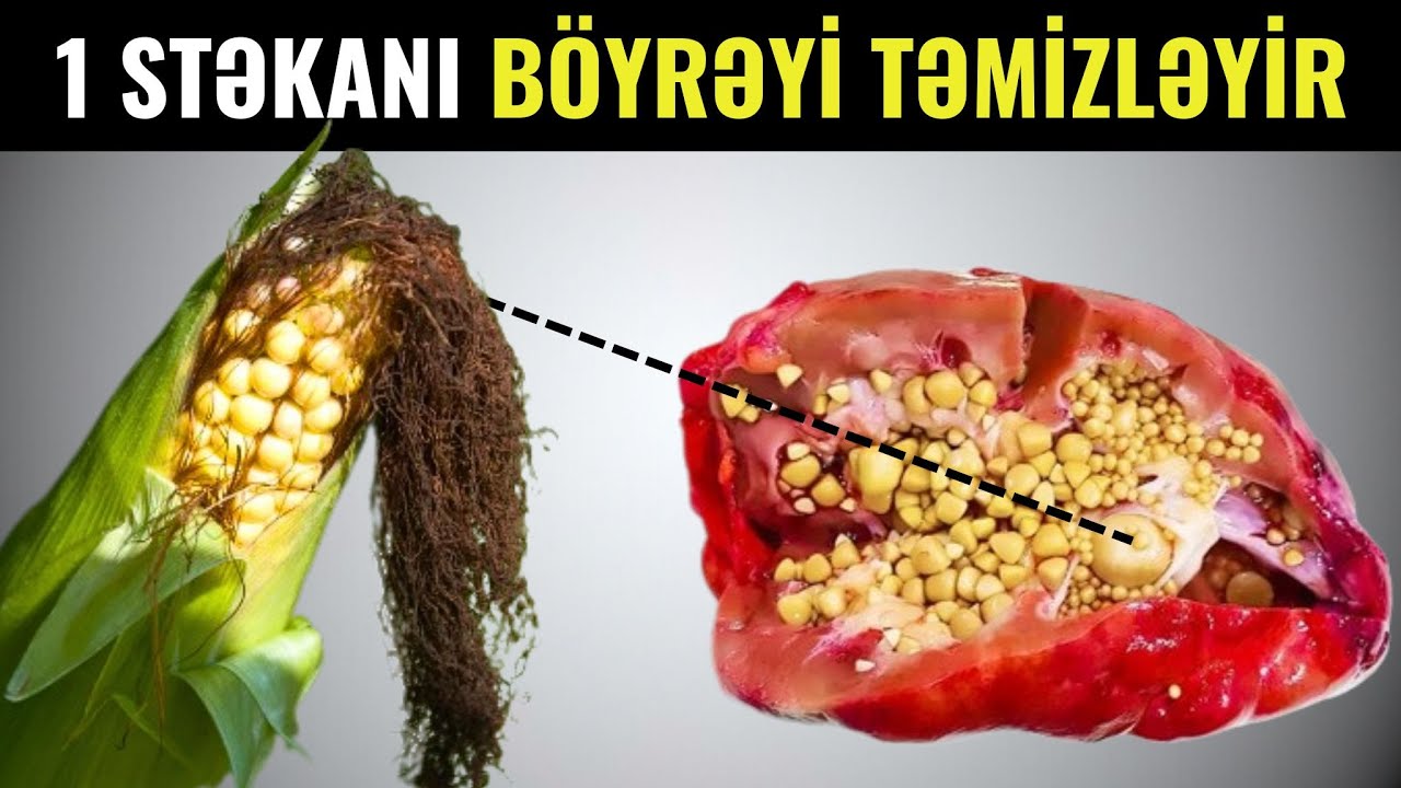 Dərmansız Böyrək Daşlarını Təmizləyin - Hər səhər için