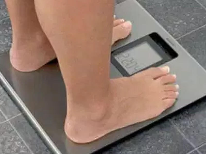 Azərbaycanlı aparıcı-aktyor 12 kiloqram arıqladı: \\\"Hələ ardı gəlir\\\" - FOTO