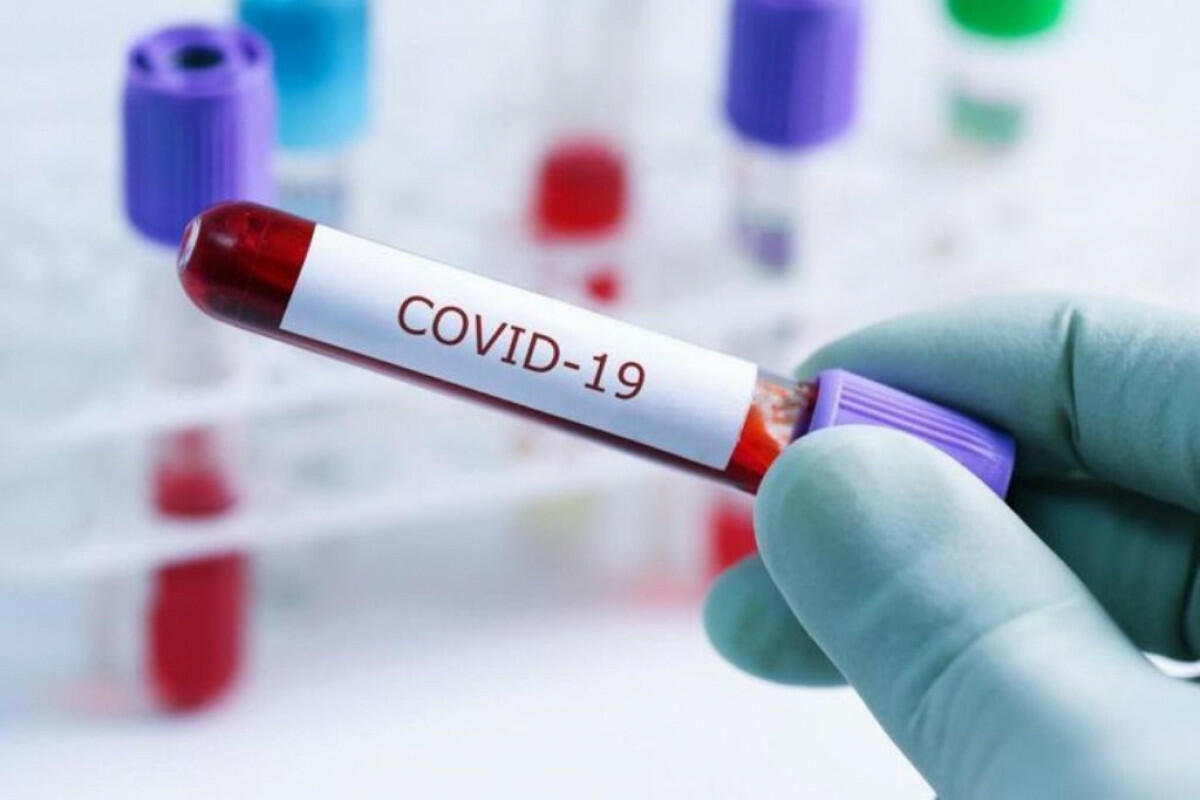 Üst-dən COVID 19-la bağlı YENİ XƏBƏR