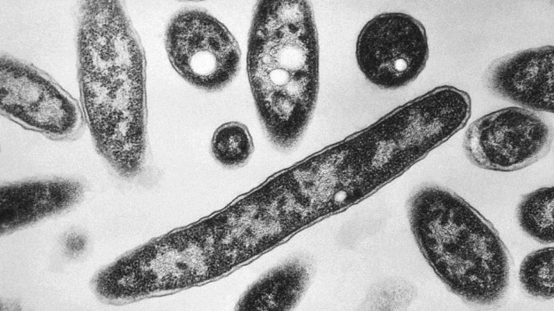 Polşada legionella bakteriyasından ölənlərin sayı 11-ə çatıb
