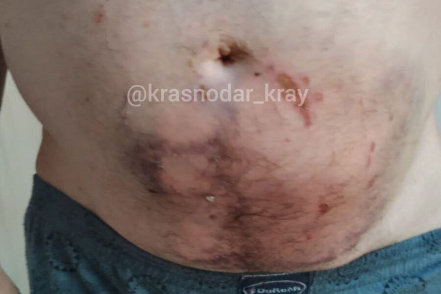 İt kişinin qarnın parçaladı