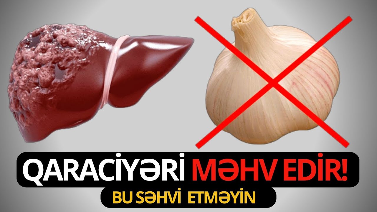 Bu 9 Qida QARACİYƏRİ Yavaş-Yavaş ÖLDÜRÜR! (VİDEO)