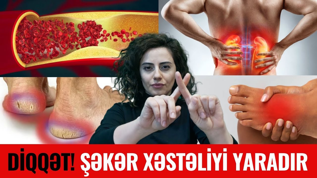 Bu Qidaları Yeyən ŞƏKƏR XƏSTƏSİ Olur - ŞOK