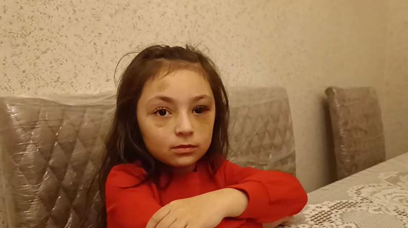 “Direktor maddiyyatla həll etmək istəyirdi” – Döyüldüyü deyilən məktəblinin ANASI – VİDEO