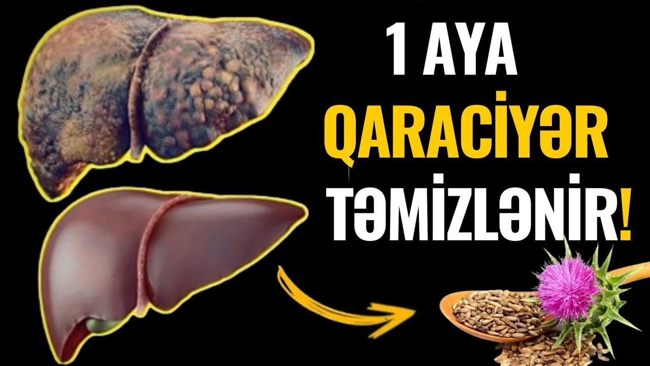 Qaraciyərin XƏSTƏ olduğunu göstərən 10 VACİB ƏLAMƏT