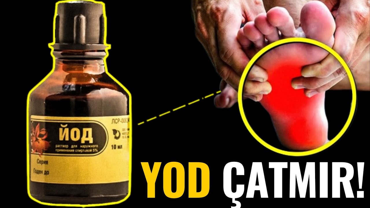 Bədəndə YOD Azlığının 11 VACİB ƏLAMƏTİ - BUNU EDİN!