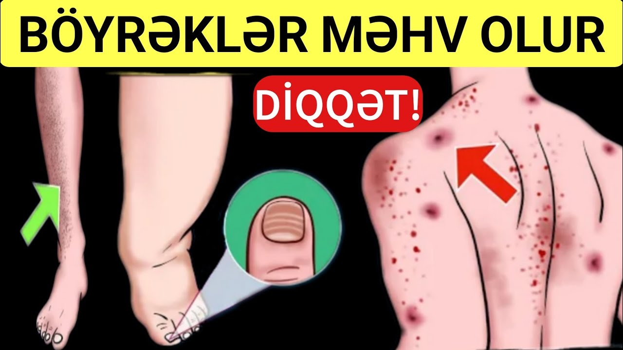 Bağırsaqları İllərin Zibilindən Təmizləyəcək - Təbii Yolla Müalicə