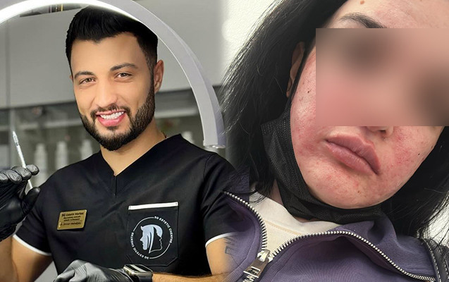 Bakıda şok! Bərbər kosmetoloq adı ilə klinikada  işləyir?  —   FOTOLAR 