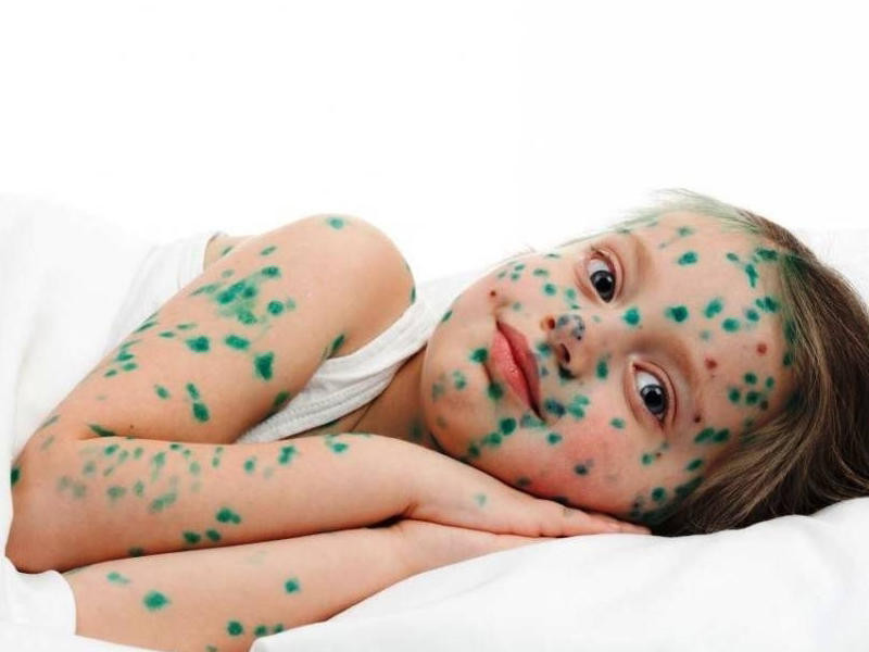 Su çiçəyi zamanı&nbsp; çimmək olarmı? - Həkimdən AÇIQLAMA&nbsp;