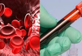 Qanımızı azaldan səbəblər