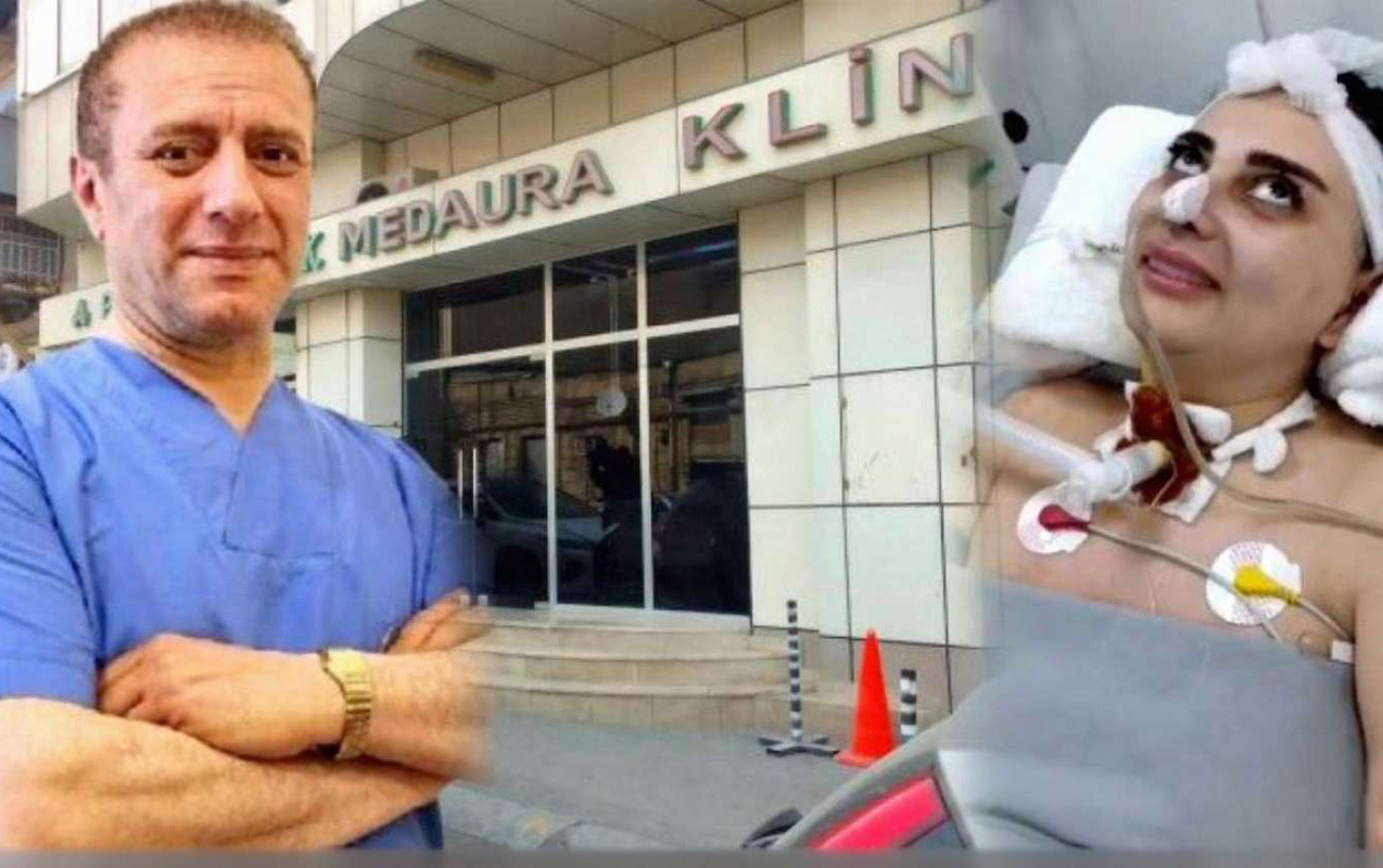 Komaya düşən Nigara görə həkimlərə cinayət işi açılıb - Fotolar 