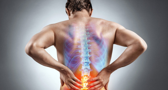 Bel ağrısı niyə bu qədər artıb? Alimlər AÇIQLADI