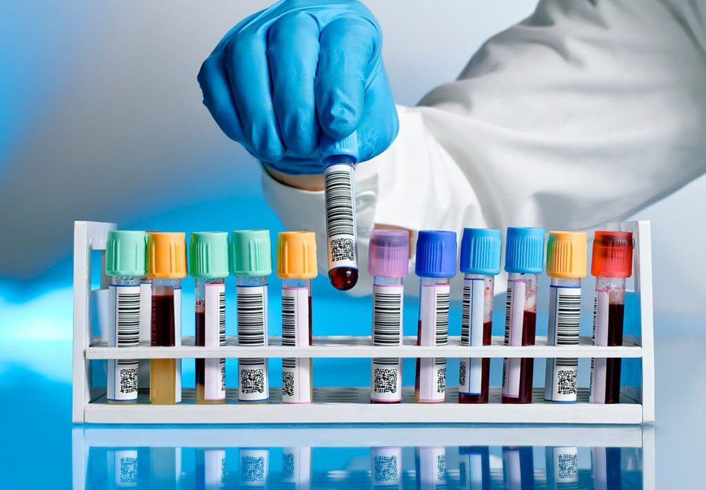 Qan analizi verib,mütləq bu rəqəmlərə DİQQƏT EDİN! - Həkim təhlükəni AÇIQLADI&nbsp;