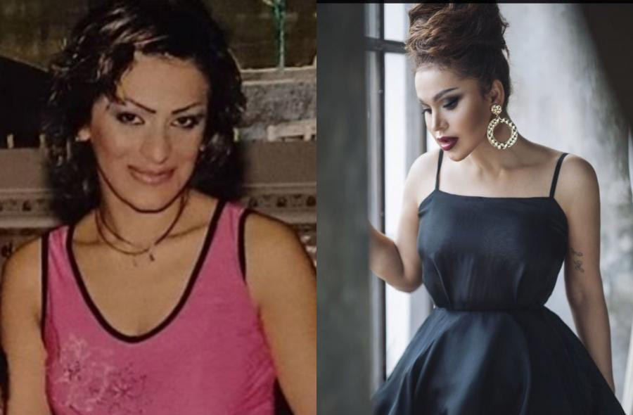 Rəqsanənin plastik əməliyyatdan əvvəlki halı - ARXİV&nbsp; FOTOSU YAYILDI&nbsp;