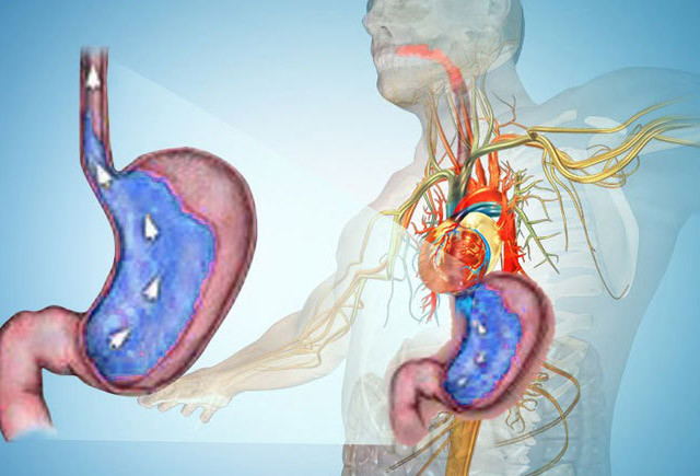 Mədə ilə ürək ağrısını necə seçək?&nbsp; —&nbsp; &nbsp;Bu yolla ayırd etmək mümkdündür