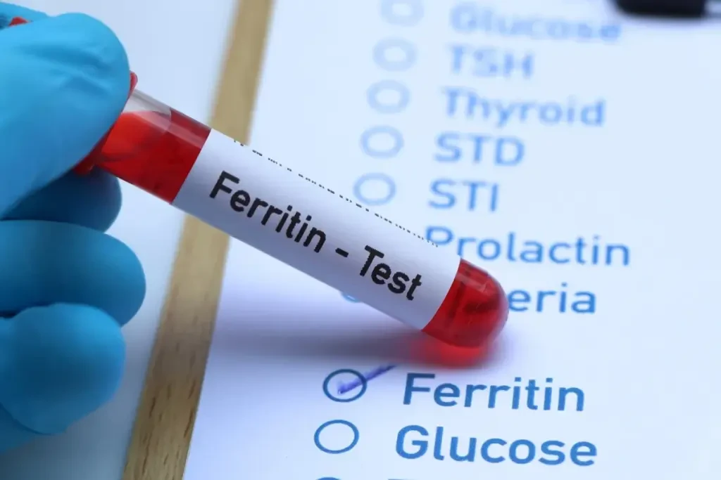 Ferritin neçə olmalıdır?&nbsp; - Hər kəsin bilməli olduğu MƏLUMAT