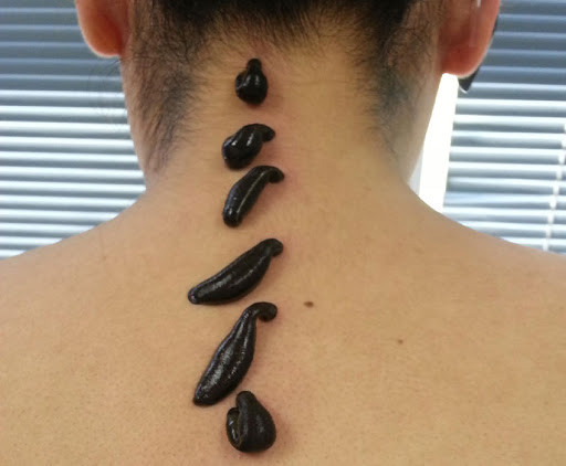  Zəli terapiyası kimlərə tətbiq edilməlidir? – FAYDALARI NƏLƏRDİR?