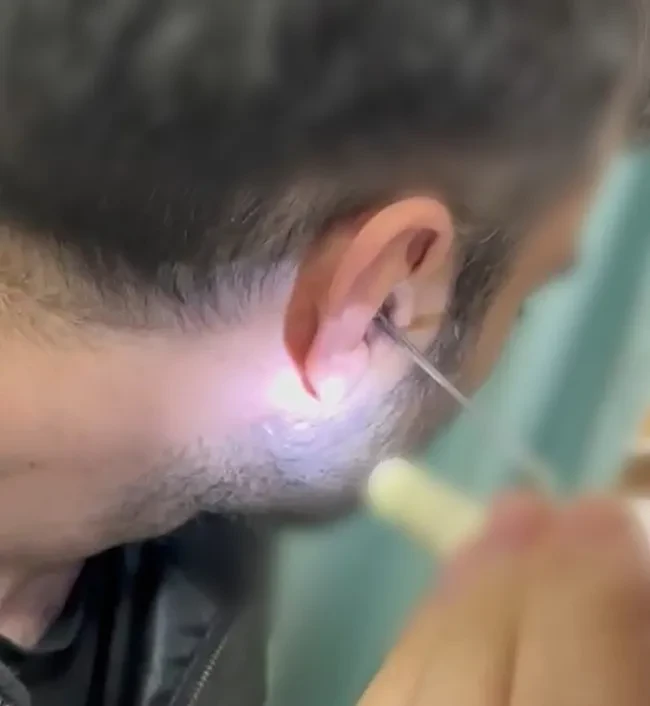 Narkotiki qulağında gizlədibmiş&nbsp; &nbsp;—&nbsp; FOTOLAR