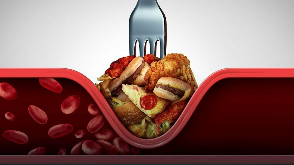 Xolesterin yüksəkdirsə nə etməli? - HƏKİM AÇIQLADI