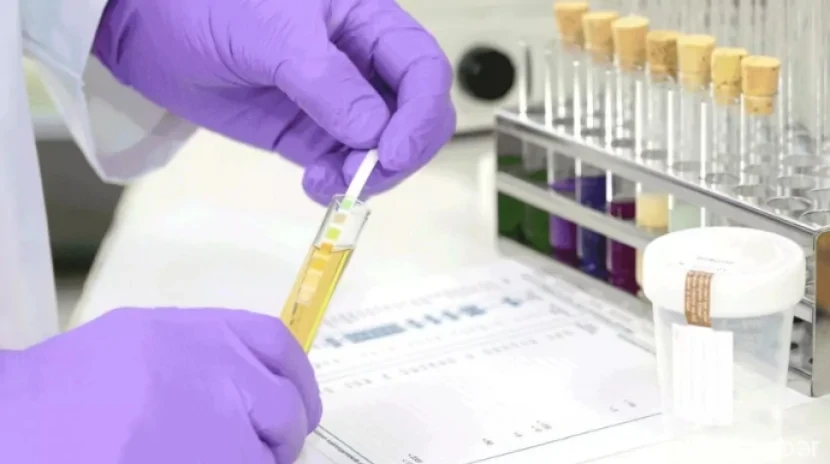 Bu şəxslərdən məcburi narkoloji test TƏLƏB OLUNACAQ