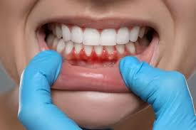 Diş həkiminə getmişdi, qollarını və ayaqlarını kəsdilər — FOTO 