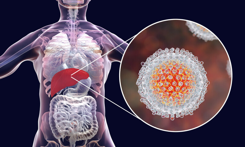 Hepatit B və C arasında fərq nədir? – Mütəxəssis izah etdi