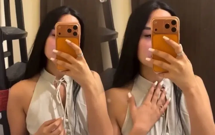 Bloger botoksdan sonra qolunun iflic olduğunu deyir