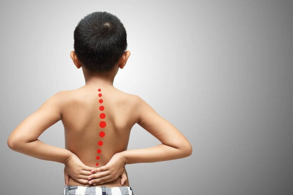 Skoliozu evdə təyin etmək mümkündürmü? – Mütəxəssisdən VALİDEYNLƏRƏ MÜHÜM XƏBƏRDARLIQ&nbsp;&nbsp;
