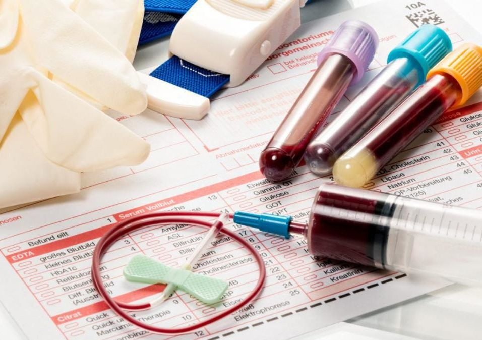 Qan analizində trombositlərin az çıxması nəyin göstəricisidir? — Pediatr-hematoloqdan xəbərdarlıq&nbsp;&nbsp;