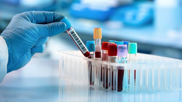 Alzheimer xəstəliyinin erkən diaqnozunda inqilab