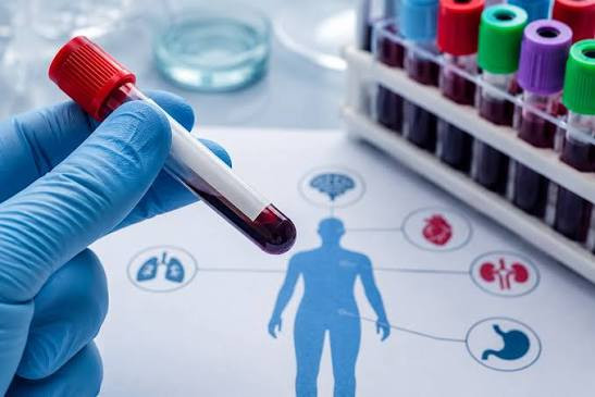 Trigliserid yüksək çıxıbsa, bu nə deməkdir? – Kardioloqdan açıqlama&nbsp;&nbsp;