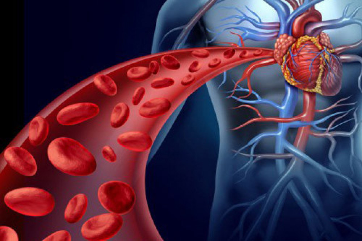 Stent qoyduranlar və təzyiq xəstələri bu xətanı edir! —&nbsp; AÇIQLAMA