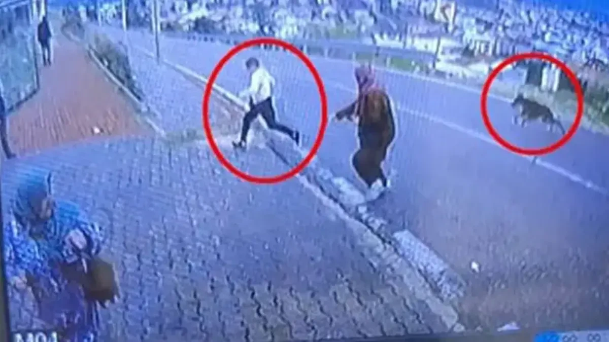 İtdən qaçarkən ayağı sındı -HADİSƏ ANI