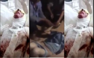 Azərbaycanda dəhşət - Ər arvadını "kislota"yla yandırdı