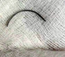 Azərbaycanda deputatın həkim qızı iynəni doğuşa gələn qadının qarnında qoydu - FOTOLAR