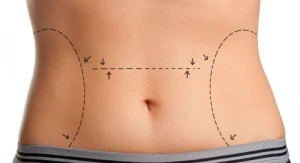 Samiraldonu əməliyyat edən plastik cərrah: “Mənə şər atırlar”