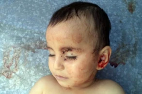 Bugün Zəhranın ildönümüdür – Foto