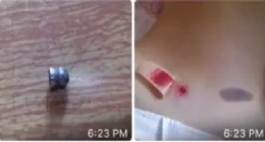 Bakıda qızlara atəş açan manyak peydə olub – ŞOK Video