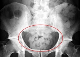 Arxasından narkotik çıxdı - Gömrükdə biabırçılıq