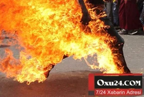 Azərbaycanda universitet müəllimi ÖZÜNÜ YANDIRDI